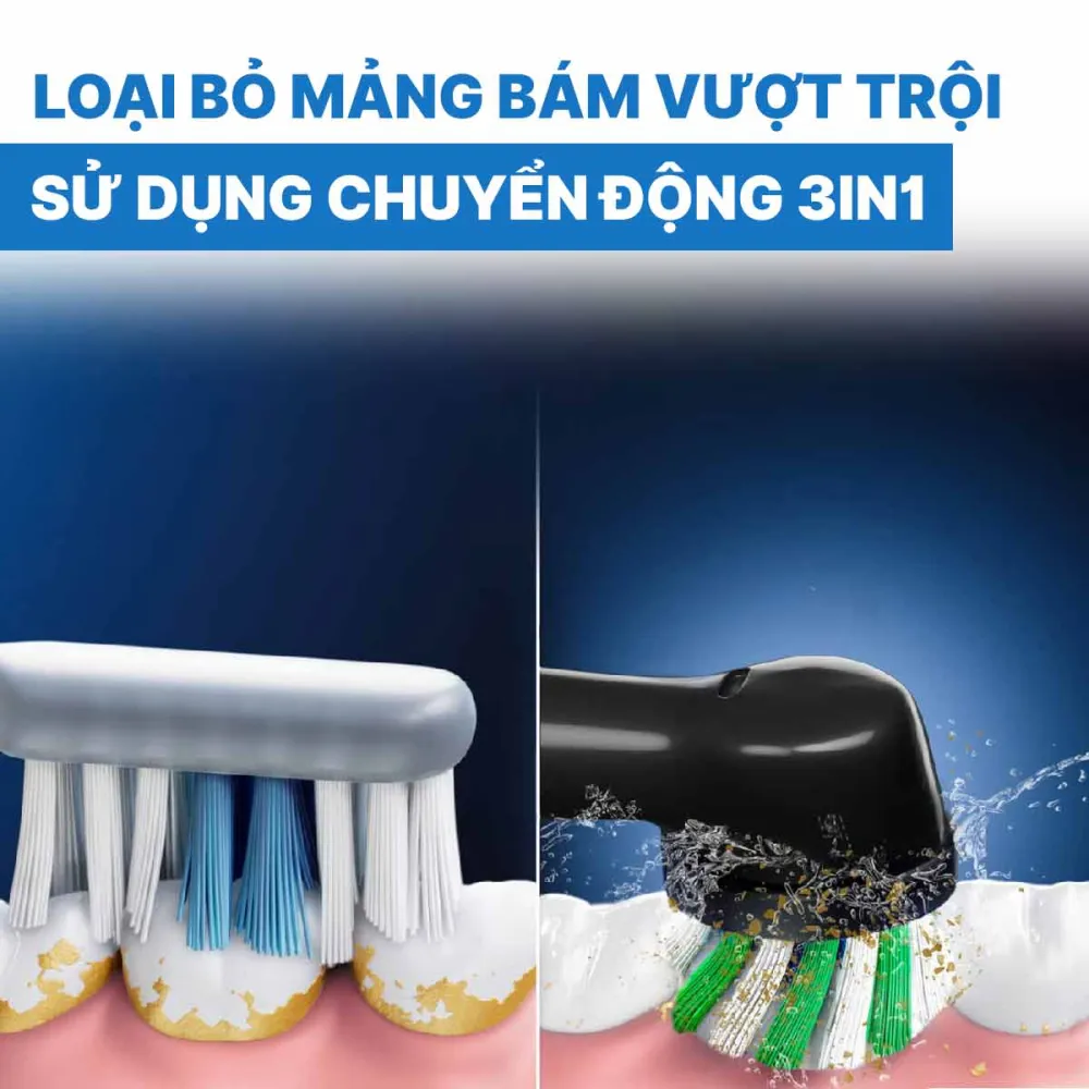 Bàn chải điện ORAL-B Pro Series 1 Plus